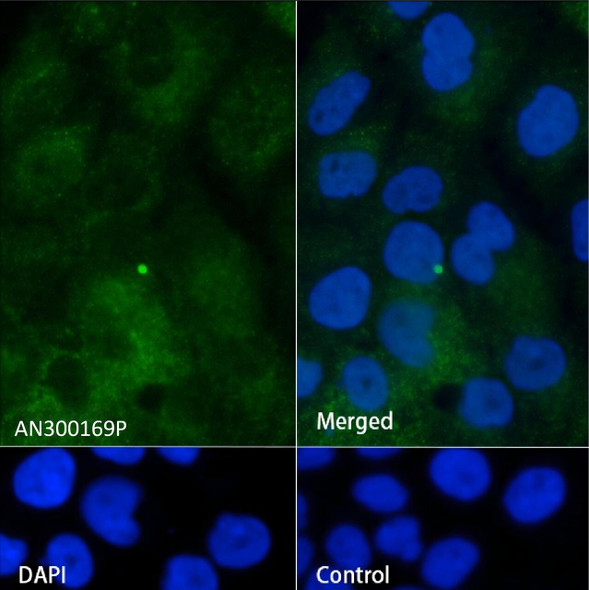 Recombinant IFITM1 Monoclonal Antibody (AGEL5438)