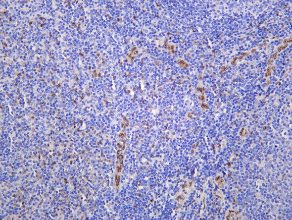 Recombinant IL-33 Monoclonal Antibody (AGEL5445)