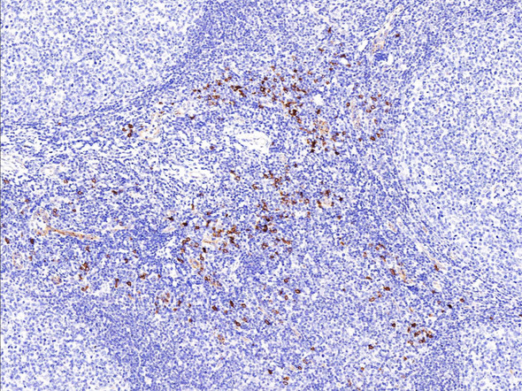 Recombinant IL3RA/CD123 Monoclonal Antibody (AGEL5450)