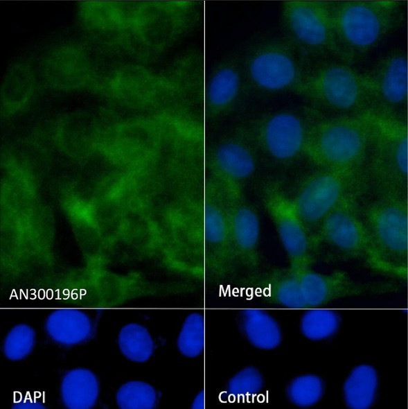 Recombinant TFPI/LACI/EPI Monoclonal Antibody (AGEL5451)