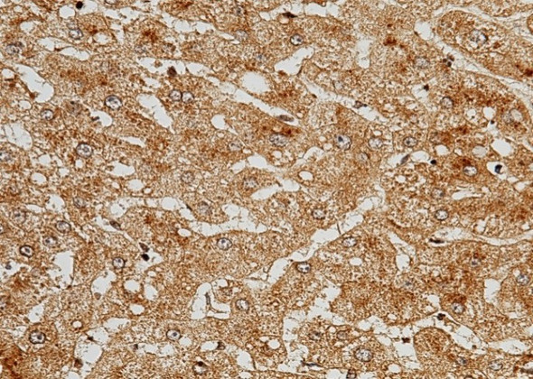 Recombinant C5a/Complement 5a Monoclonal Antibody (AGEL5453)