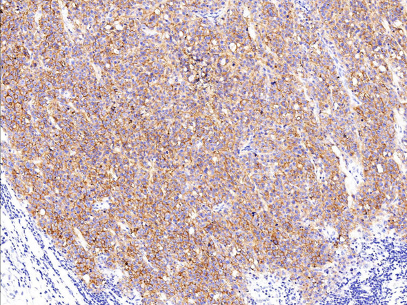 Recombinant EpCAM/TROP-1/TACSTD1 Monoclonal Antibody (AGEL5454)