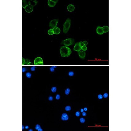 Recombinant EpCAM/TROP-1/TACSTD1 Monoclonal Antibody (AGEL5454)