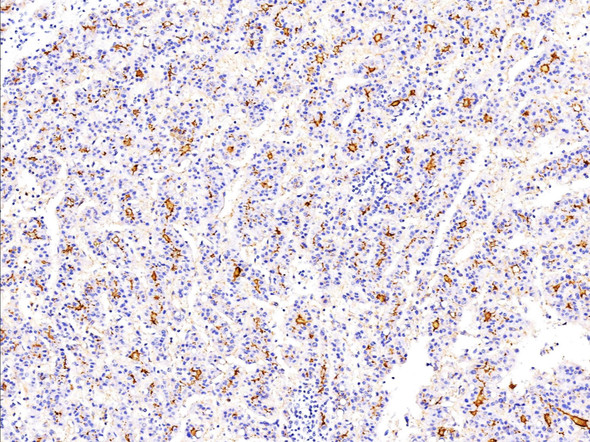 Recombinant CEACAM1/CD66a Monoclonal Antibody (AGEL5458)