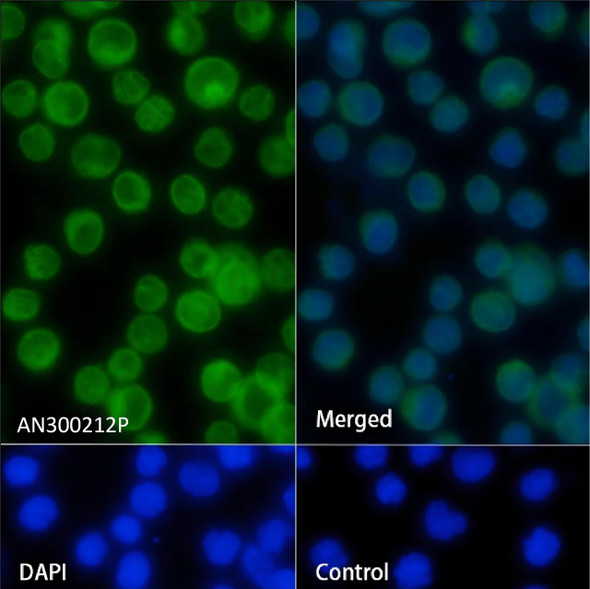 Recombinant CD3d/CD3 delta Monoclonal Antibody (AGEL5461)