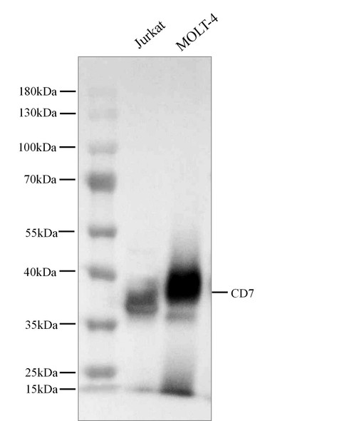Recombinant CD7 Monoclonal Antibody (AGEL5463)