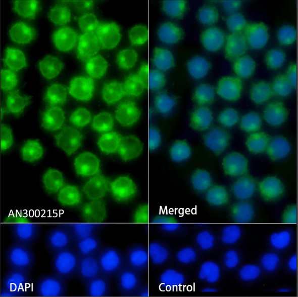 Recombinant CD7 Monoclonal Antibody (AGEL5463)