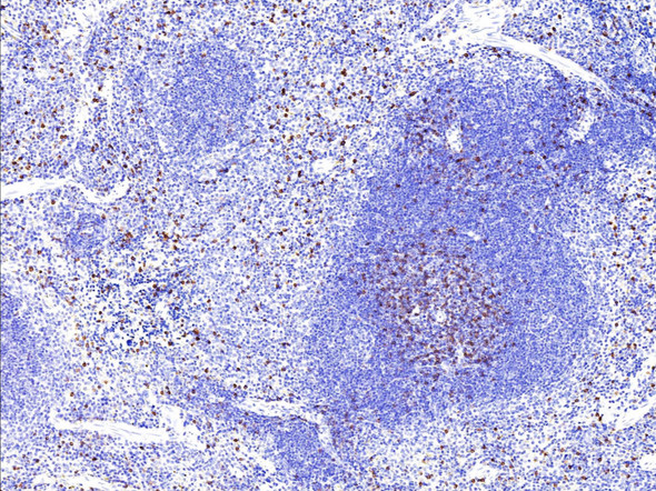 Recombinant CD8B/P37/LEU2 Monoclonal Antibody (AGEL5464)