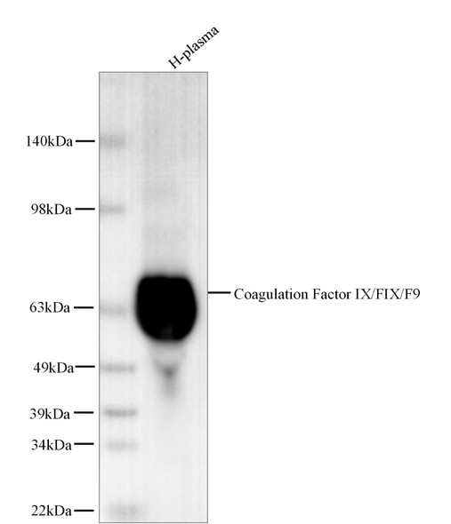 Recombinant Coagulation Factor IX/FIX/F9 Monoclonal Antibody (AGEL5476)
