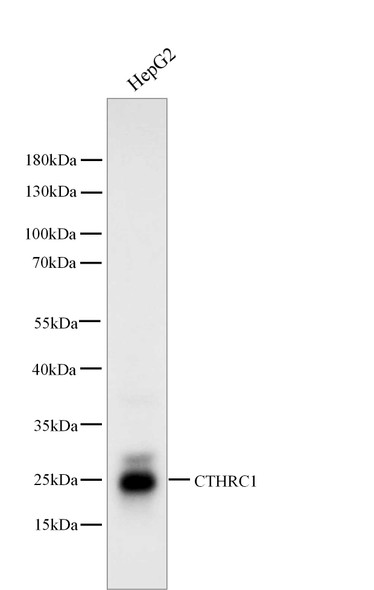 Recombinant CTHRC1 Monoclonal Antibody (AGEL5478)