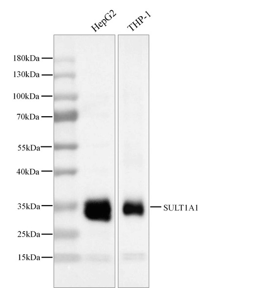 Recombinant SULT1A1 Monoclonal Antibody (AGEL5479)