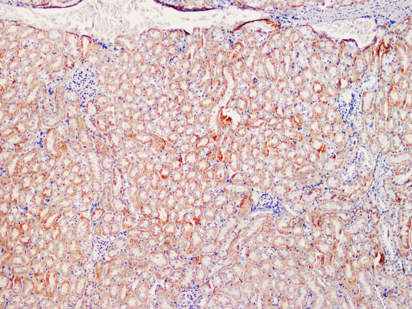 Recombinant SOD2 Monoclonal Antibody (AGEL5487)