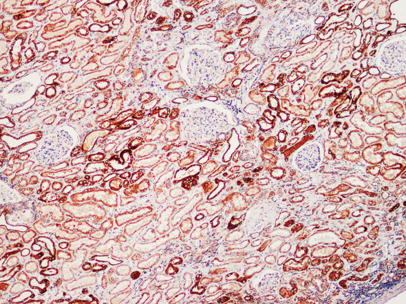 Recombinant SOD2 Monoclonal Antibody (AGEL5487)