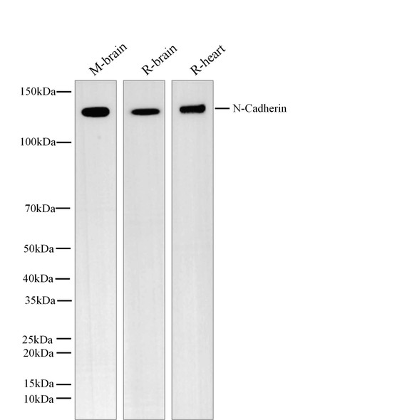Recombinant N-Cadherin/CD325/CDH2 Monoclonal Antibody (AGEL5494)