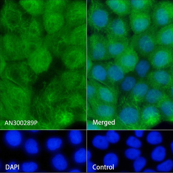 Recombinant KRT14/Cytokeratin 14 Monoclonal Antibody (AGEL5495)