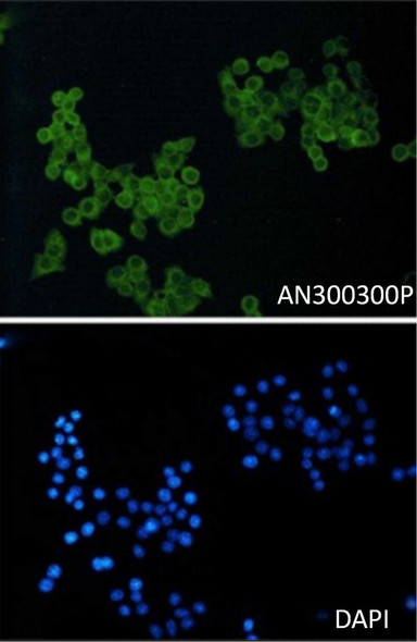 Recombinant CD146/MCAM Monoclonal Antibody (AGEL5496)