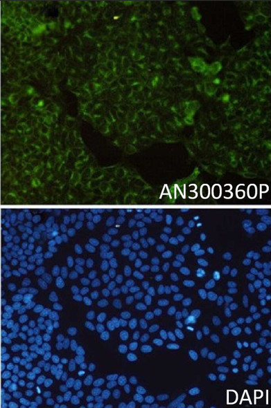Recombinant Transferrin Receptor/TFRC/CD71 Monoclonal Antibody (AGEL5504)