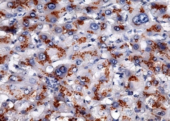 Recombinant Apolipoprotein H/APOH Monoclonal Antibody (AGEL5507)
