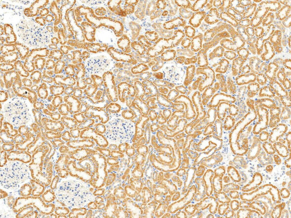 Recombinant Thioredoxin-2/TXN2 Monoclonal Antibody (AGEL5513)