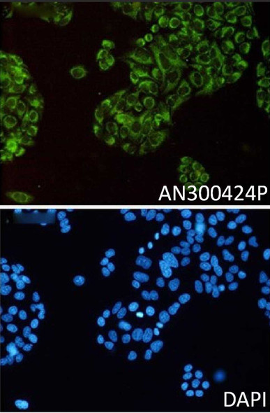 Recombinant Thioredoxin-2/TXN2 Monoclonal Antibody (AGEL5513)