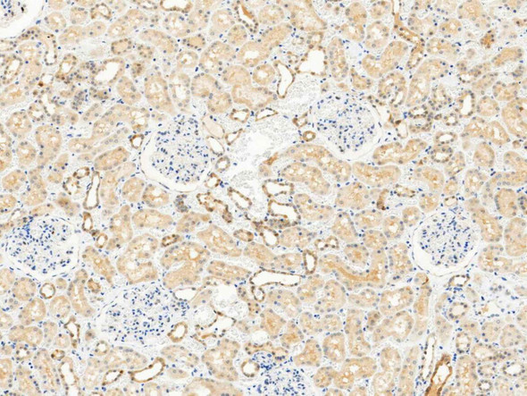 Recombinant RRM2B/P53R2 Monoclonal Antibody (AGEL5514)