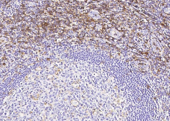 Recombinant PSGL-1/CD162/SELPLG Monoclonal Antibody (AGEL5516)