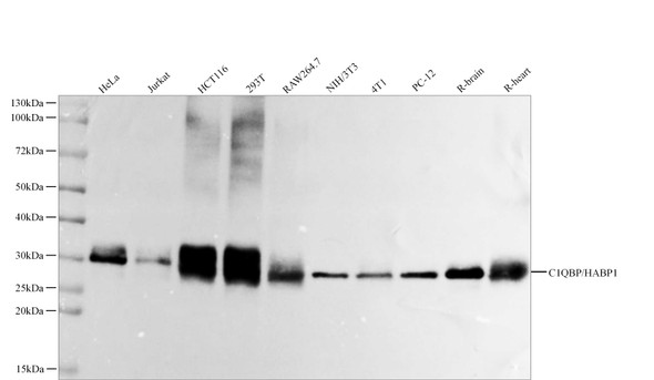 Recombinant C1QBP/HABP1 Monoclonal Antibody (AGEL5522)