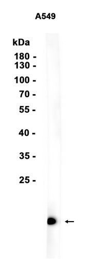 Recombinant Uteroglobin/SCGB1A1 Monoclonal Antibody (AGEL5524)