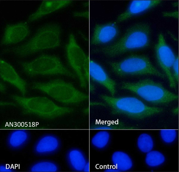 Recombinant ICAM-1/CD54 Monoclonal Antibody (AGEL5526)