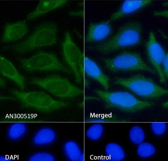 Recombinant ICAM-1/CD54 Monoclonal Antibody (AGEL5527)