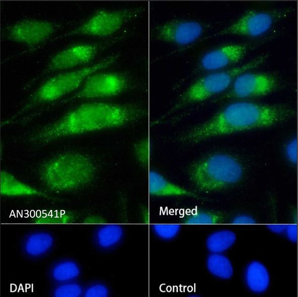 Recombinant P4HB Monoclonal Antibody (AGEL5530)