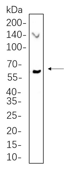 Recombinant Phospho-Chk2 (Thr68) Monoclonal Antibody (AGEL5538)