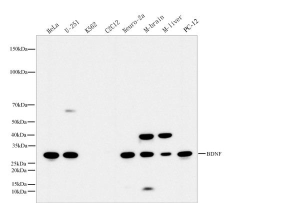 Recombinant BDNF Monoclonal Antibody (AGEL5543)