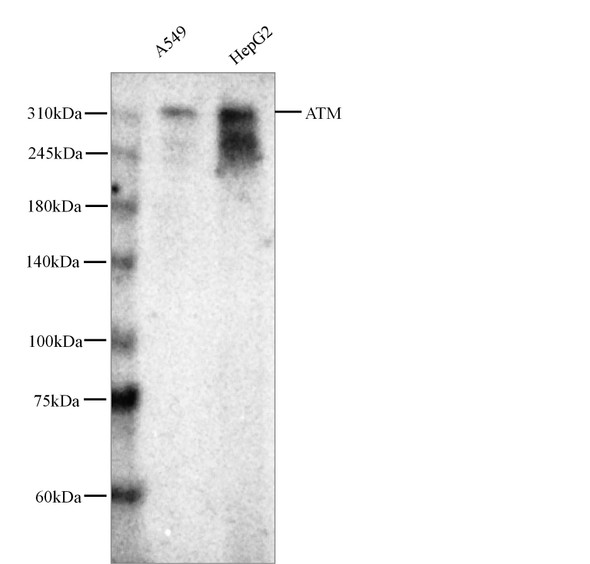 Recombinant ATM Monoclonal Antibody (AGEL5556)