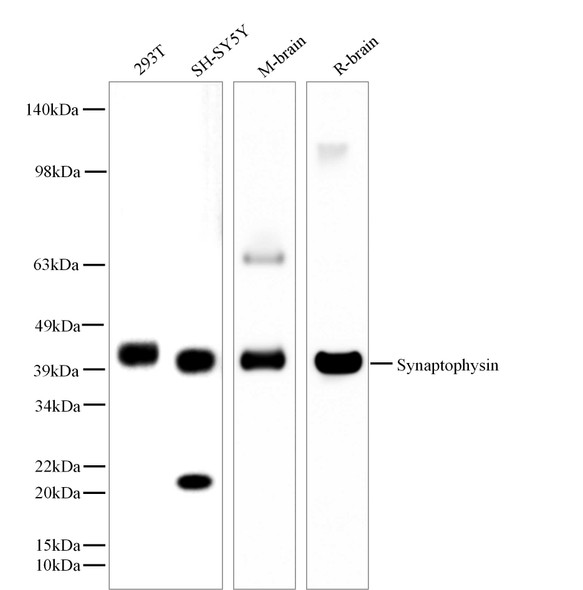 Recombinant Synaptophysin Monoclonal Antibody (AGEL5557)