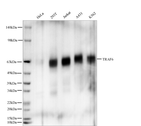 Recombinant TRAF6 Monoclonal Antibody (AGEL5558)