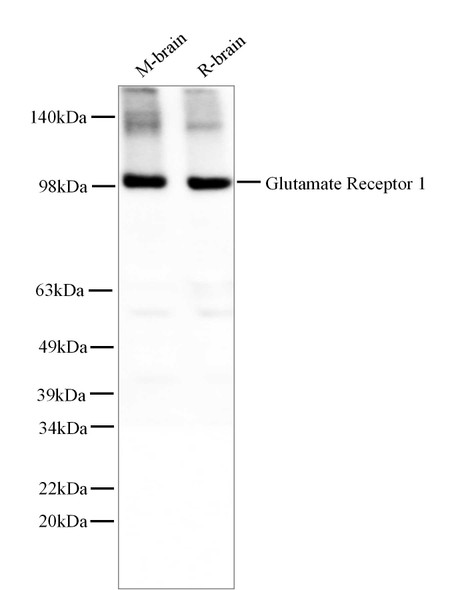Recombinant Glutamate Receptor 1 Monoclonal Antibody (AGEL5561)