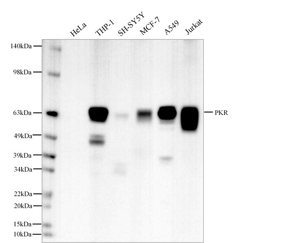 Recombinant PKR Monoclonal Antibody (AGEL5592)