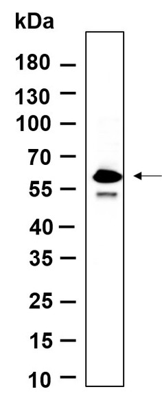Recombinant Phospho-SMAD5 (Ser463, Ser465) Monoclonal Antibody (AGEL5598)