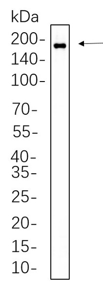 Recombinant Phospho-HER2 (Tyr1221, 1222) Monoclonal Antibody (AGEL5603)