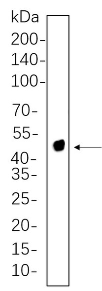 Recombinant NDRG1 Monoclonal Antibody (AGEL5606)