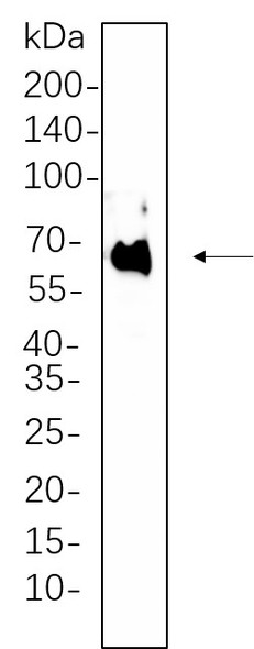 Recombinant PDPK1 Monoclonal Antibody (AGEL5610)
