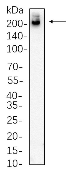 Recombinant Tuberin Monoclonal Antibody (AGEL5613)