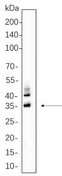 Recombinant C/EBP α Monoclonal Antibody (AGEL5614)