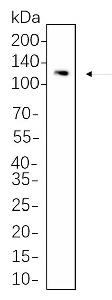 Recombinant STAT2 Monoclonal Antibody (AGEL5615)