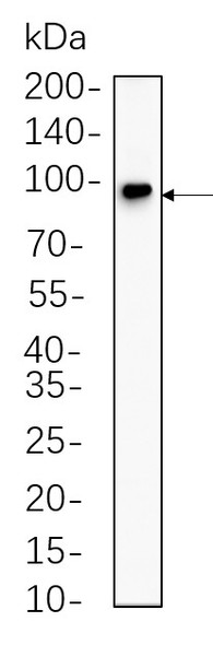 Recombinant Insulin Receptor β Monoclonal Antibody (AGEL5619)