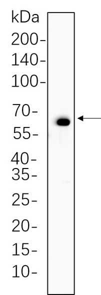 Recombinant Phospho-Paxillin (Tyr118) Monoclonal Antibody (AGEL5635)