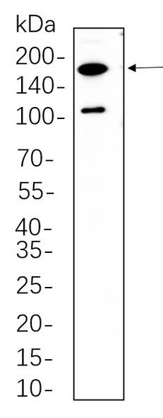Recombinant Rictor Monoclonal Antibody (AGEL5642)