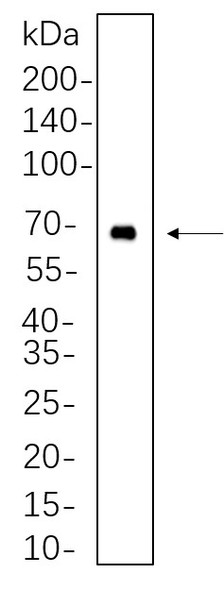 Recombinant BTK Monoclonal Antibody (AGEL5646)