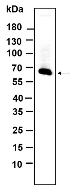 Recombinant MMP2 Monoclonal Antibody (AGEL5655)